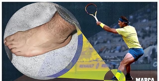 MAD带队取胜!,纳达尔重要时刻重要助攻热度持续攀升(纳达尔 对手) MAD带队取胜!,纳达尔重要时刻重要助攻热度持续攀升(纳达尔 对手)